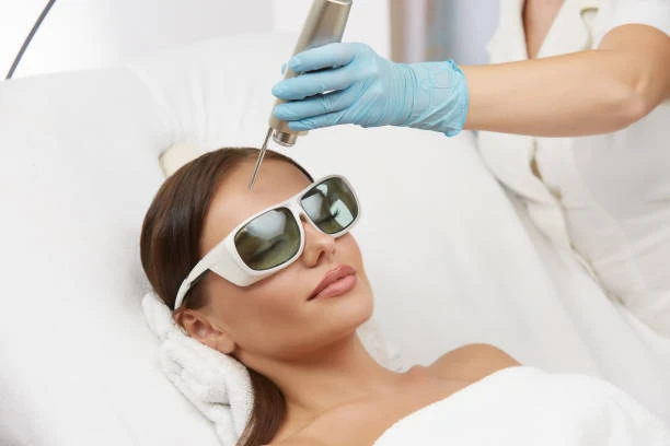 Tratamento facial a laser