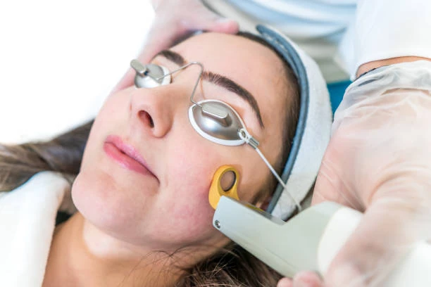 Tratamento a laser para melasma